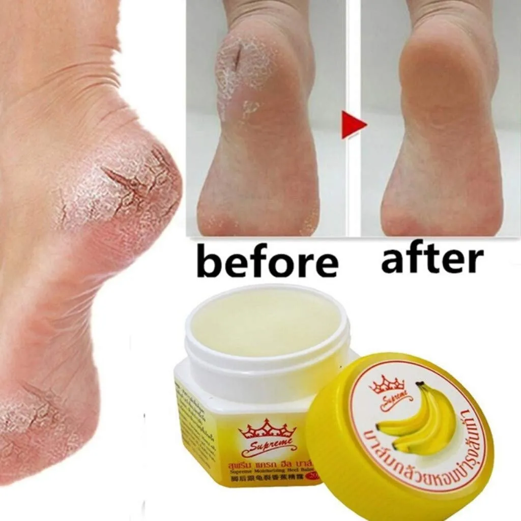 Supreme Natural Softening Banana Heel Cream, 20 gram